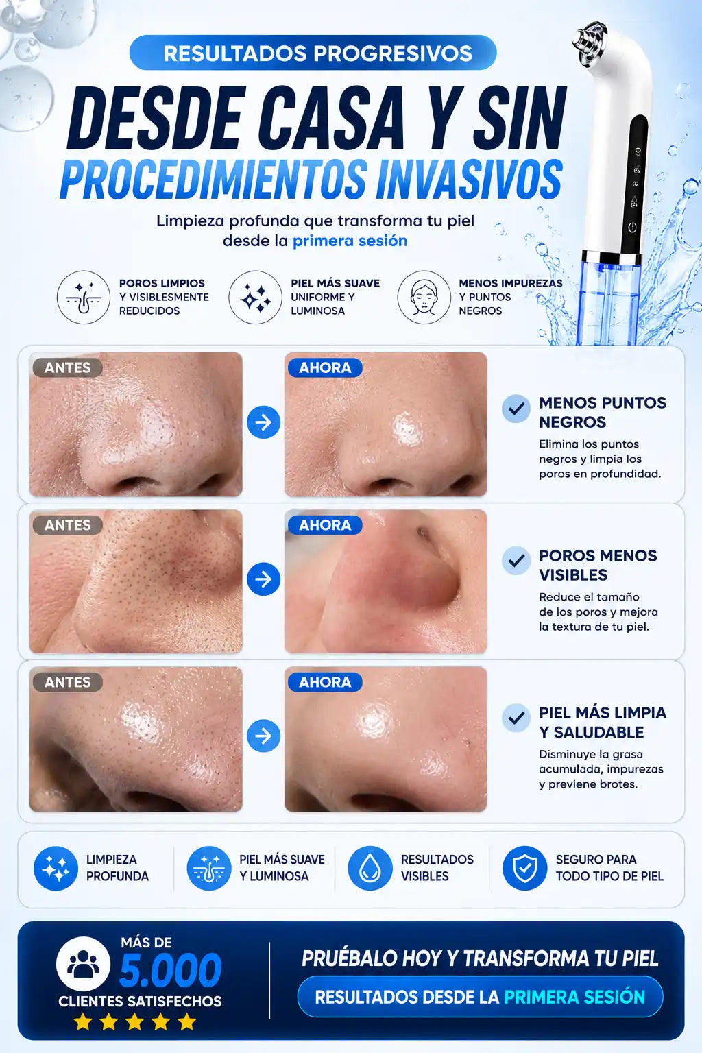 HydraPore™ Consigue una piel limpia y libre de puntos negros desde la primera sesión sin maltratar ni pellizcar tu rostro